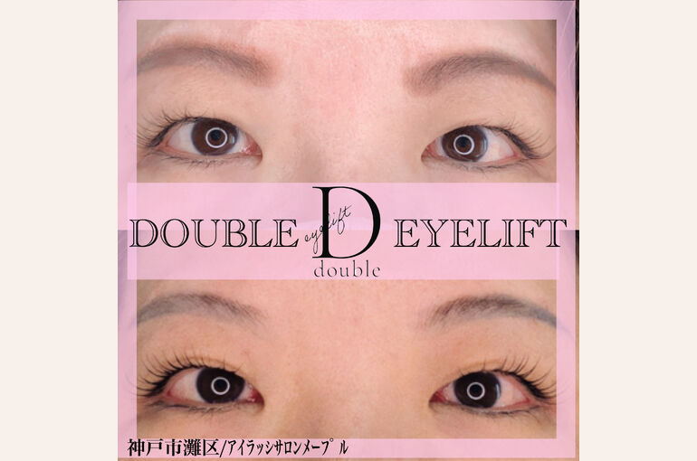 8BF75628-F844-47D1-BB58-FBFDC8B3BA3D