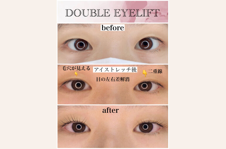 6176FF1C-9809-4121-B9E5-613F872C66BA