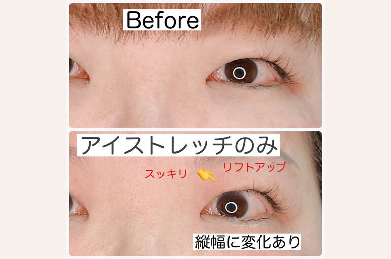 51B841AA-6E7E-478B-B5D9-BFCDFD50CB2D